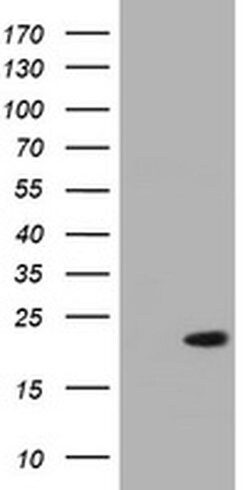 NME1 Monoclonal Antibody (OTI7F4), TrueMAB , OriGene 100 &mu;L | Buy Online | Origene Technologies | Fisher Scientific