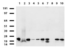 NME1 Mouse anti-Canine, Human, Rat, Clone: UMAB92, lyophilized, UltraMAB