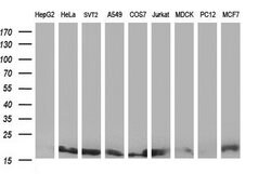 NME2 Mouse anti-Human, Clone: OTI2F9, lyophilized, TrueMAB 100 &mu;g; Unconjugated:Antibodies,