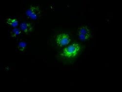 NME4 Monoclonal Antibody (OTI5E4), TrueMAB , OriGene 30 &mu;L; Unconjugated:Antibodies,