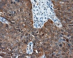 NME4 Monoclonal Antibody (OTI1C11), TrueMAB , OriGene 100 &mu;L; Unconjugated:Antibodies,