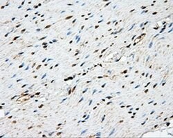 NME4 Monoclonal Antibody (OTI1C11), TrueMAB , OriGene 100 &mu;L; Unconjugated:Antibodies,