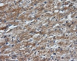 NME4 Monoclonal Antibody (OTI5E4), TrueMAB , OriGene 30 &mu;L; Unconjugated:Antibodies,