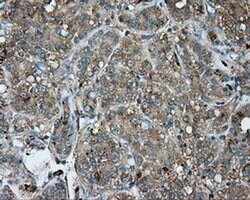 NME4 Monoclonal Antibody (OTI2G1), TrueMAB , OriGene 30 &mu;L; Unconjugated:Antibodies,