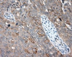 NME4 Monoclonal Antibody (OTI1E3), TrueMAB , OriGene 30 &mu;L; Unconjugated:Antibodies,