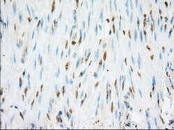 NME4 Monoclonal Antibody (OTI2B10), TrueMAB , OriGene 100 &mu;L; Unconjugated:Anticuerpos