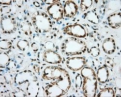 NME4 Monoclonal Antibody (OTI2B10), TrueMAB , OriGene 100 &mu;L; Unconjugated:Anticuerpos