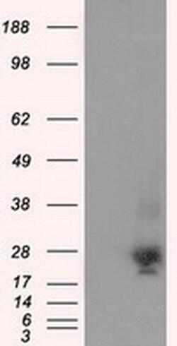 NME4 Monoclonal Antibody (OTI1A5), TrueMAB , OriGene 30 &mu;L | Buy Online | OriGene | Fisher Scientific