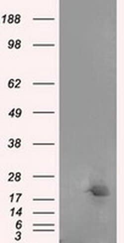 NME4 Monoclonal Antibody (OTI1E3), TrueMAB , OriGene 30 &mu;L; Unconjugated:Antibodies,