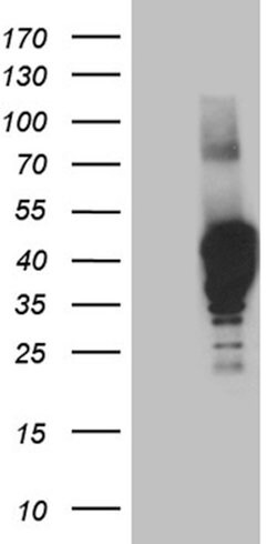 NMI Mouse anti-Human, Clone: OTI2C1, lyophilized, TrueMAB 100 &mu;g; Unconjugated:Antibodies,