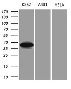 NMI Mouse anti-Human, Clone: OTI2C1, lyophilized, TrueMAB 100 &mu;g; Unconjugated:Antibodies,
