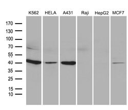 NMI Mouse anti-Human, Clone: OTI5H1, lyophilized, TrueMAB 100 &mu;g | Buy Online | Origene Technologies | Fisher Scientific
