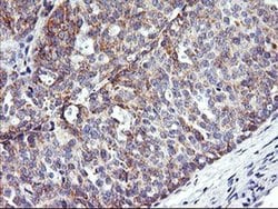 NMT2 Monoclonal Antibody (OTI1B4), TrueMAB , OriGene 100 &mu;L; Unconjugated:Antibodies,