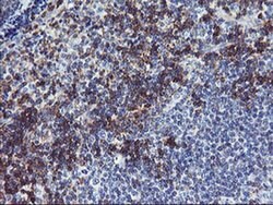 NMT2 Monoclonal Antibody (OTI1B4), TrueMAB , OriGene:Antibodies:Primary