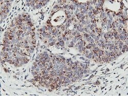 NMT2 Monoclonal Antibody (OTI1G3), TrueMAB , OriGene:Antibodies:Primary