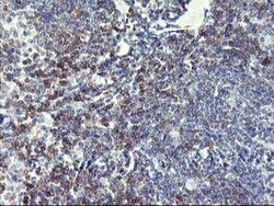 NMT2 Mouse anti-Human, Clone: OTI2B4, lyophilized, TrueMAB 100 &mu;g; Unconjugated:Antibodies,