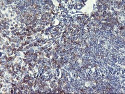 NMT2 Monoclonal Antibody (OTI2B4), TrueMAB , OriGene 30 &mu;L; Unconjugated:Antibodies,