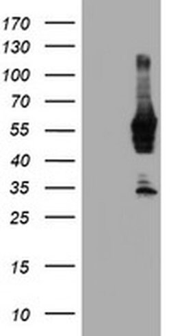 NMT2 Monoclonal Antibody (OTI1B4), TrueMAB , OriGene:Antibodies:Primary