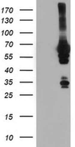 NMT2 Monoclonal Antibody (OTI1B11), TrueMAB , OriGene 30 &mu;L; Unconjugated:Antibodies,