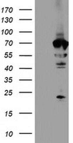 NMT2 Monoclonal Antibody (OTI1G3), TrueMAB , OriGene 30 &mu;L; Unconjugated:Antibodies,