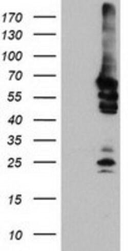NMT2 Mouse anti-Human, Clone: OTI2B4, lyophilized, TrueMAB 100 &mu;g; Unconjugated:Antibodies,