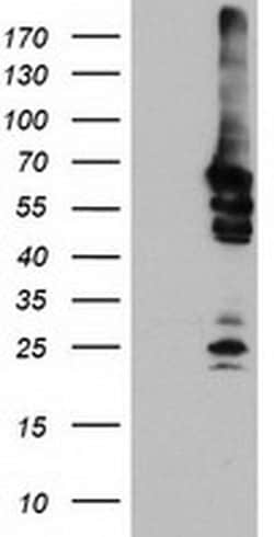 NMT2 Monoclonal Antibody (OTI2B4), TrueMAB , OriGene 30 &mu;L; Unconjugated:Antibodies,