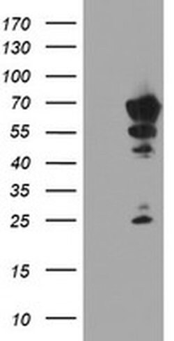 NMT2 Monoclonal Antibody (OTI1D7), TrueMAB , OriGene:Antibodies:Primary