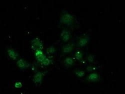NNMT Monoclonal Antibody (OTI1A1), TrueMAB , OriGene 100 &mu;L; Unconjugated:Antibodies,