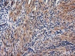 NNMT Monoclonal Antibody (OTI1A1), TrueMAB , OriGene 100 &mu;L; Unconjugated:Antibodies,