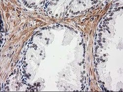 NNMT Monoclonal Antibody (OTI1A1), TrueMAB , OriGene 100 &mu;L; Unconjugated:Antibodies,