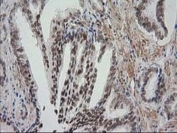 NNMT Monoclonal Antibody (OTI1A1), TrueMAB , OriGene 100 &mu;L; Unconjugated:Antibodies,