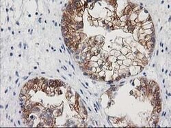 NNMT Monoclonal Antibody (OTI3E3), TrueMAB , OriGene:Antibodies:Primary
