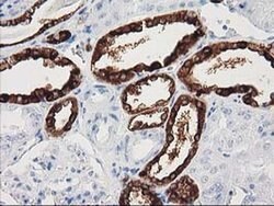 NNMT Monoclonal Antibody (OTI3E3), TrueMAB , OriGene 30 &mu;L; Unconjugated:Antibodies,
