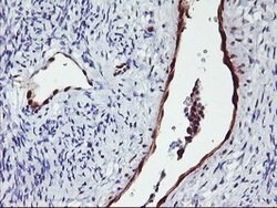 NNMT Mouse anti-Human, Clone: OTI2G8, lyophilized, TrueMAB 100 &mu;g; Unconjugated:Antibodies,