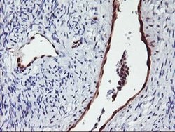 NNMT Monoclonal Antibody (OTI2G8), TrueMAB , OriGene 100 &mu;L; Unconjugated:Antibodies,
