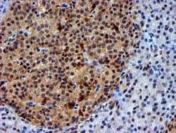 NNMT Mouse anti-Human, Mouse, Clone: OTI3D8, lyophilized, TrueMAB 100 &mu;g;