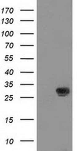 NNMT Monoclonal Antibody (OTI1A1), TrueMAB , OriGene 100 &mu;L; Unconjugated:Antibodies,