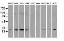 NNMT Monoclonal Antibody (OTI1A1), TrueMAB , OriGene 100 &mu;L; Unconjugated:Antibodies,