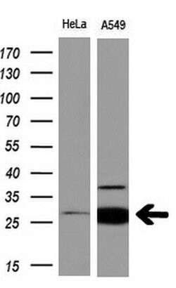 NNMT Monoclonal Antibody (OTI3E3), TrueMAB , OriGene 30 &mu;L; Unconjugated:Antibodies,