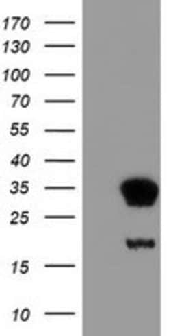 NNMT Mouse anti-Human, Clone: OTI2G8, lyophilized, TrueMAB 100 &mu;g; Unconjugated:Antibodies,