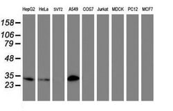 NNMT Mouse anti-Human, Clone: OTI2G8, lyophilized, TrueMAB 100 &mu;g; Unconjugated:Antibodies,