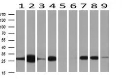 NNMT Mouse anti-Human, Clone: OTI2G8, lyophilized, TrueMAB 100 &mu;g; Unconjugated:Antibodies,