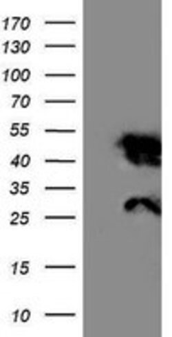 NNMT Mouse anti-Human, Mouse, Clone: OTI3D8, lyophilized, TrueMAB 100 &mu;g;