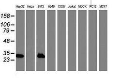 NNMT Mouse anti-Human, Mouse, Clone: OTI3D8, lyophilized, TrueMAB 100 &mu;g;