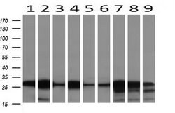 NNMT Mouse anti-Human, Mouse, Clone: OTI3D8, lyophilized, TrueMAB 100 &mu;g;