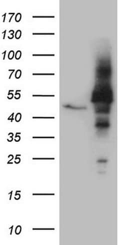 NOB1 Monoclonal Antibody (OTI4H3), TrueMAB , OriGene 100 &mu;L; Unconjugated:Antibodies,