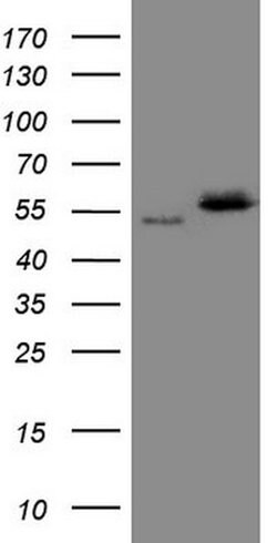 NOB1 Mouse anti-Human, Clone: OTI2F5, lyophilized, TrueMAB 100 &mu;g; Unconjugated:Antibodies,