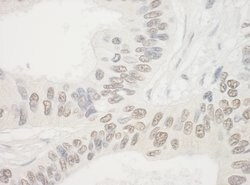 NOL10 Rabbit anti-Human, Polyclonal, Bethyl Laboratories 100 &mu;L; Unconjugated:Antibodies,
