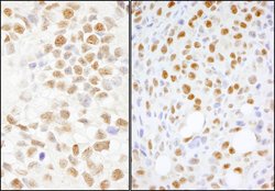 NONO Rabbit anti-Human, Mouse, Rat, Polyclonal, Bethyl Laboratories 100