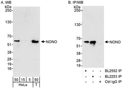 NONO Rabbit anti-Human, Polyclonal, Bethyl Laboratories 100 &mu;L; Unconjugated:Antibodies,